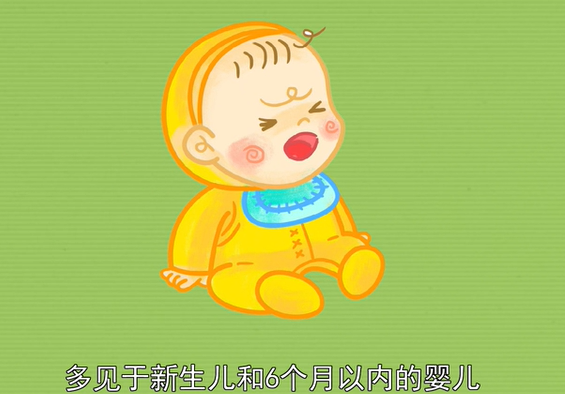 RSV疫苗多见于新生婴儿